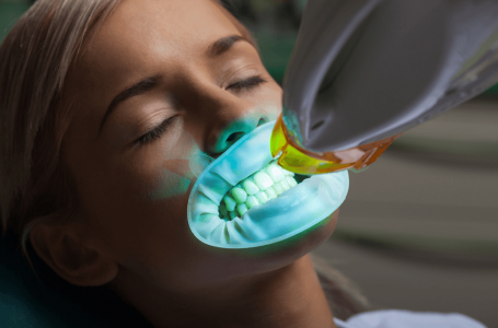 Wybielanie zębów u dentysty – jaki to koszt dla pacjenta i jak często można je wykonywać?